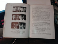 Oral and dental diseases : aetiology, histopathology, clinical features and treatment by Hubert H. Stones c1951